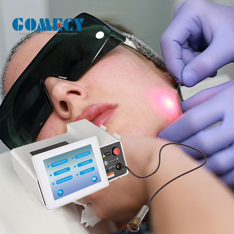Endo Laser Lift Surgery 980nm 1470nm Lipolysis Laser Fat Removal Endolaser Machine