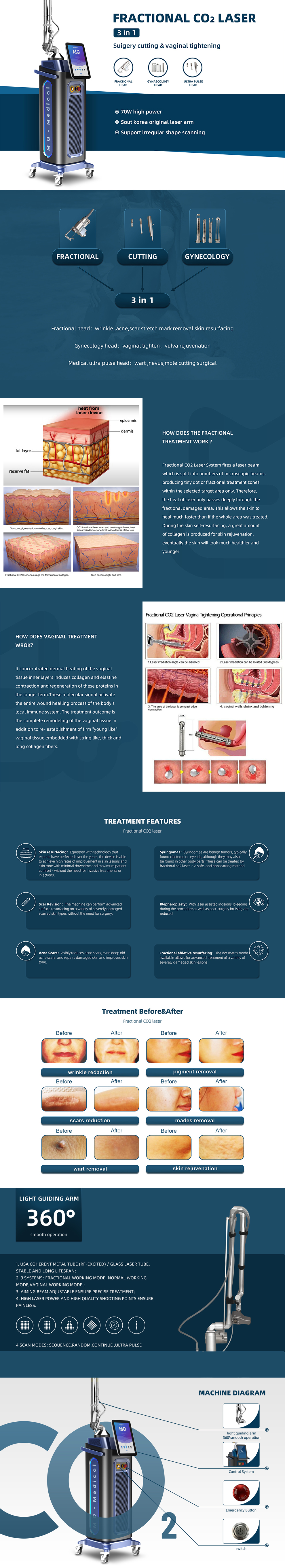 Fractional CO2 Laser Device