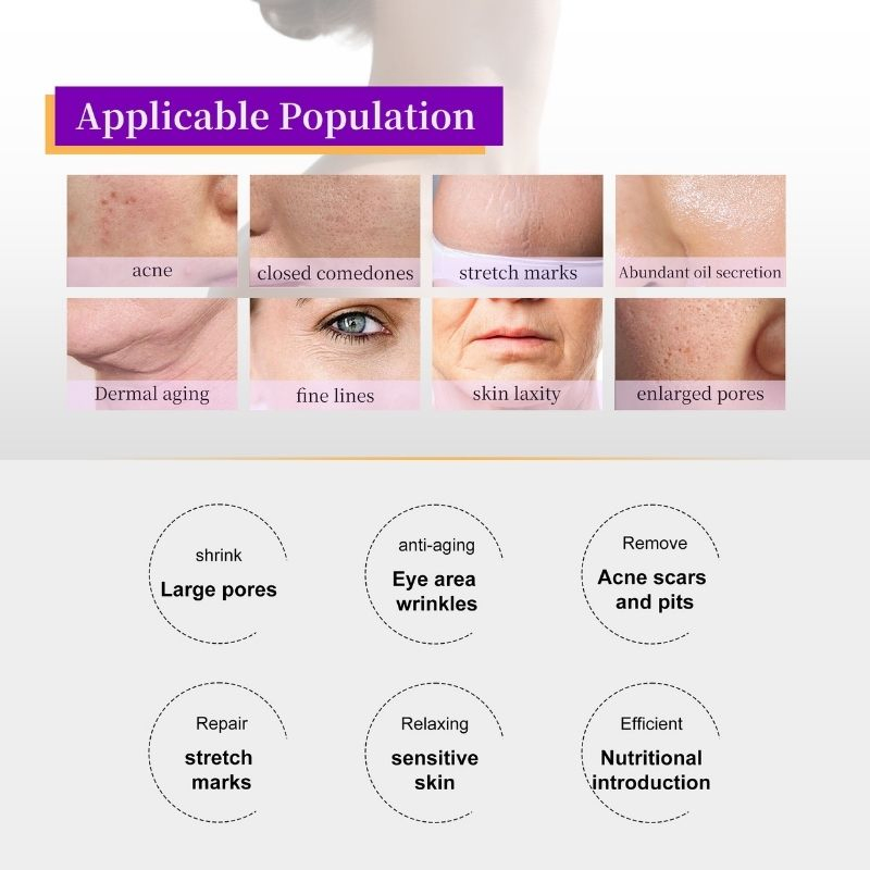 Professional Acne Scar Removal RF Microneedle System with Gold Plated Insulated Needles