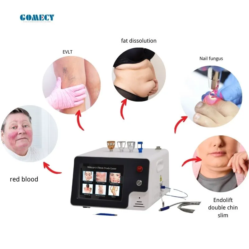 Facial Contouring