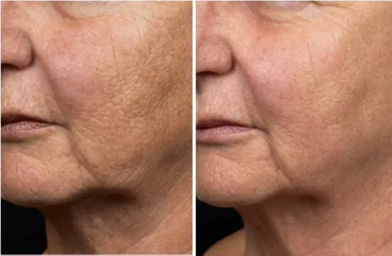 Before and After 1