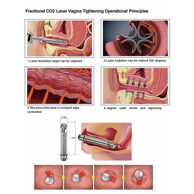 Medical CE Clinic Use Top Quality Co2 Fractional Laser Machine Vaginal Repair Co2 Fractional Ablative Laser Co2 Laser