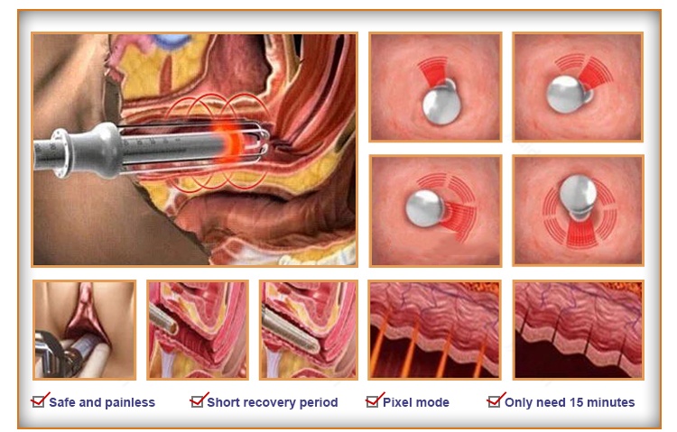 Treatment Results
