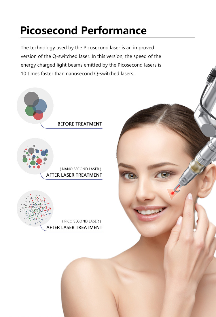 Beijing Sanhe Beauty Picosecond Q-Switched NdYAG Laser Machine OPT Technology 1064nm/532nm Wavelengths 3000W Power For
