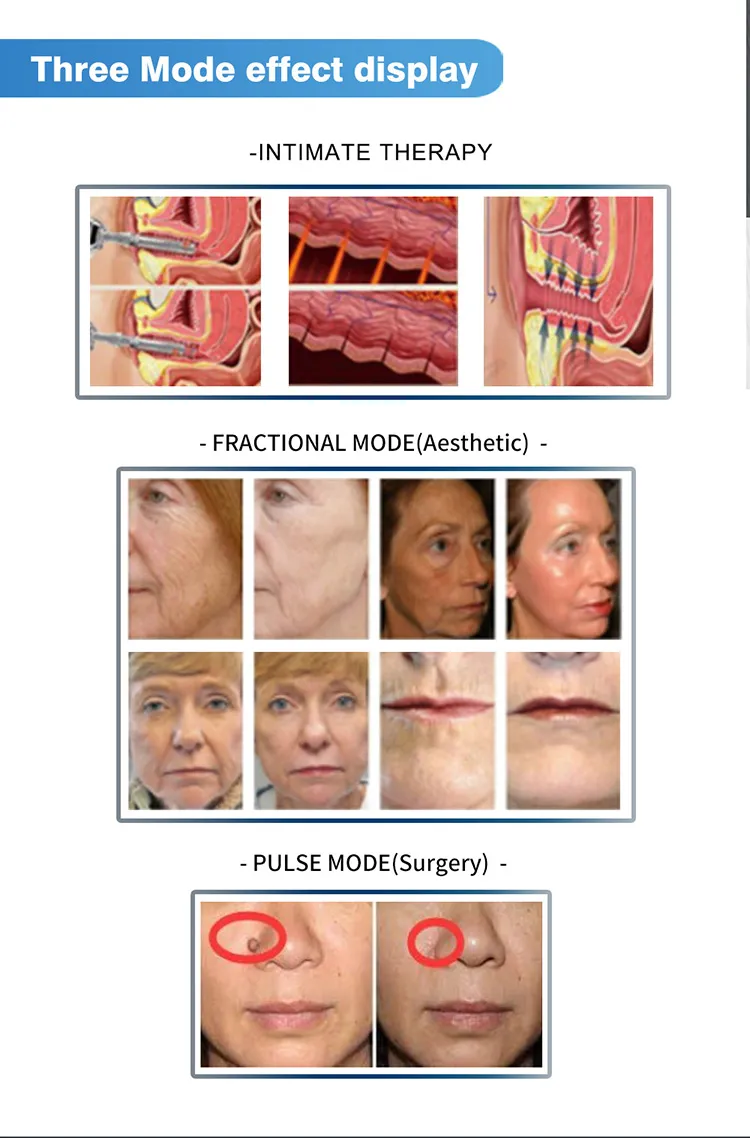 Treatment Results