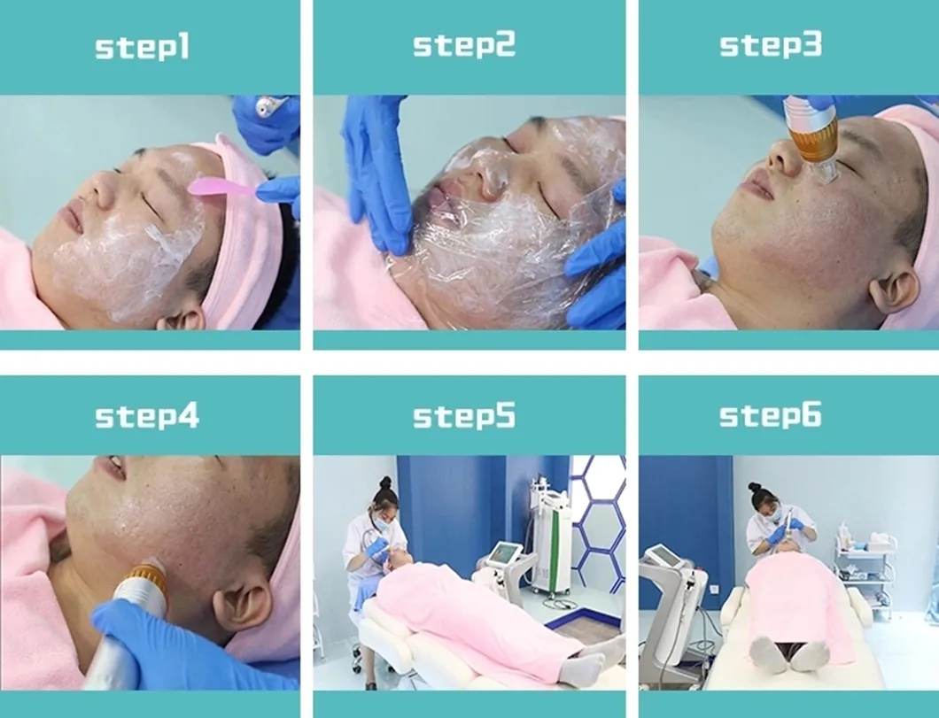 Face Treatment Radio Frequency Micro Needle Skin Nurse System Detail 5