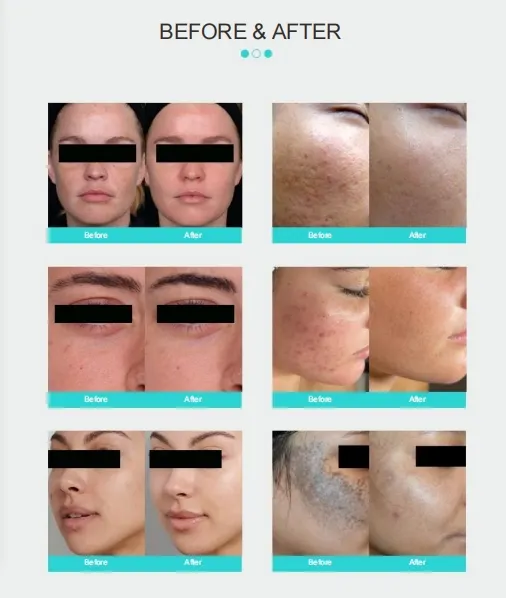 Before and After Results