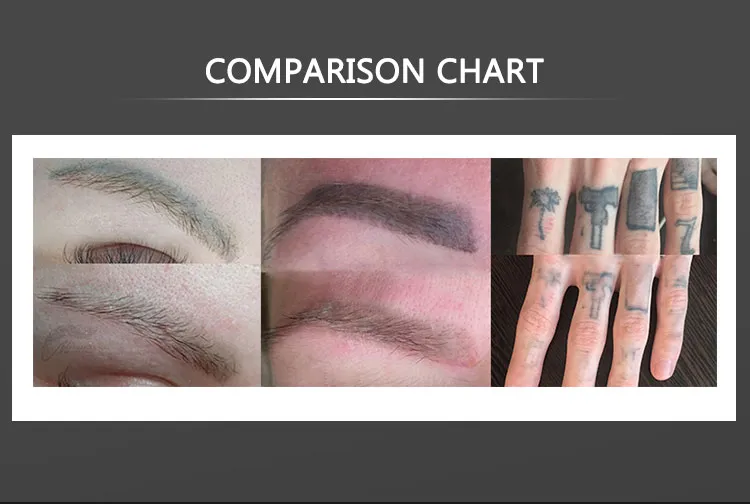 Before and After Results