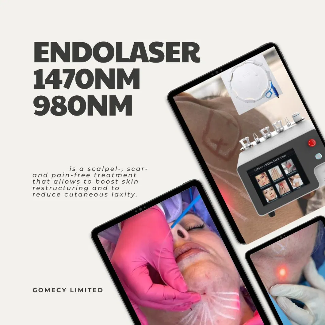 Laser Slimming