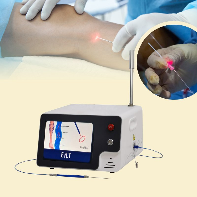 Medical Diode Laser System for Evlt Minimally Invasive Vein Therapy