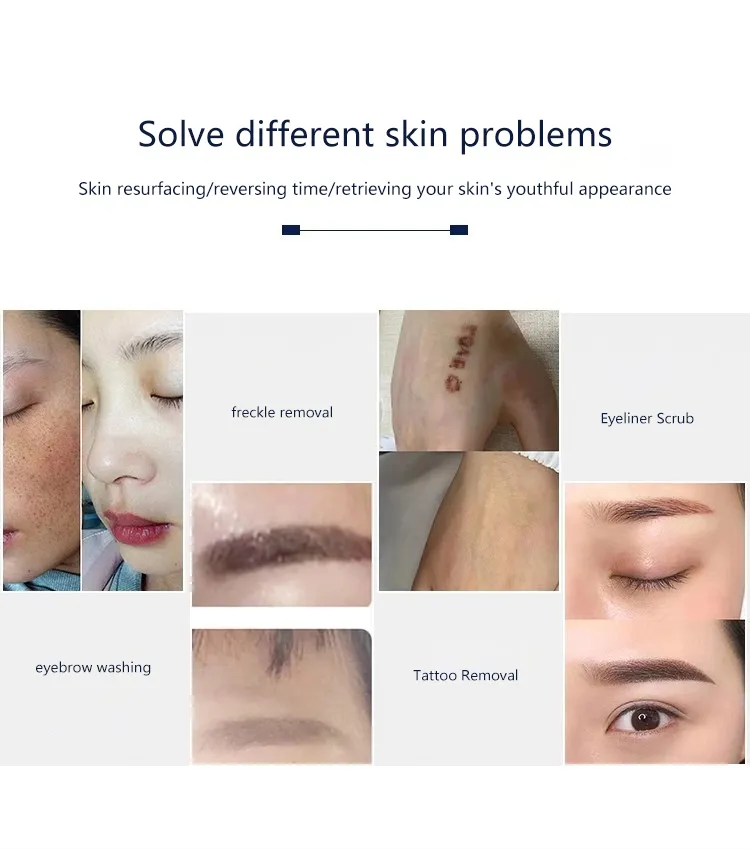 Laser Beauty System 3