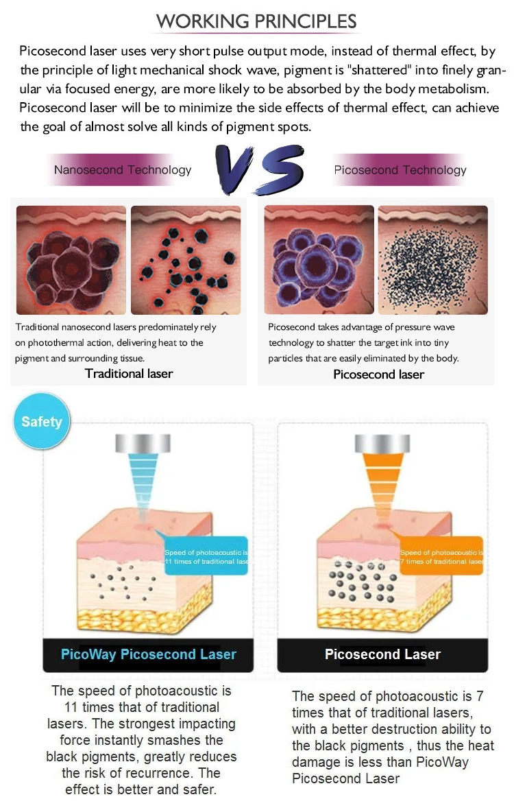 Advanced Super Pico Laser Picosecond Laser System Tattoo Removal Pigmentation