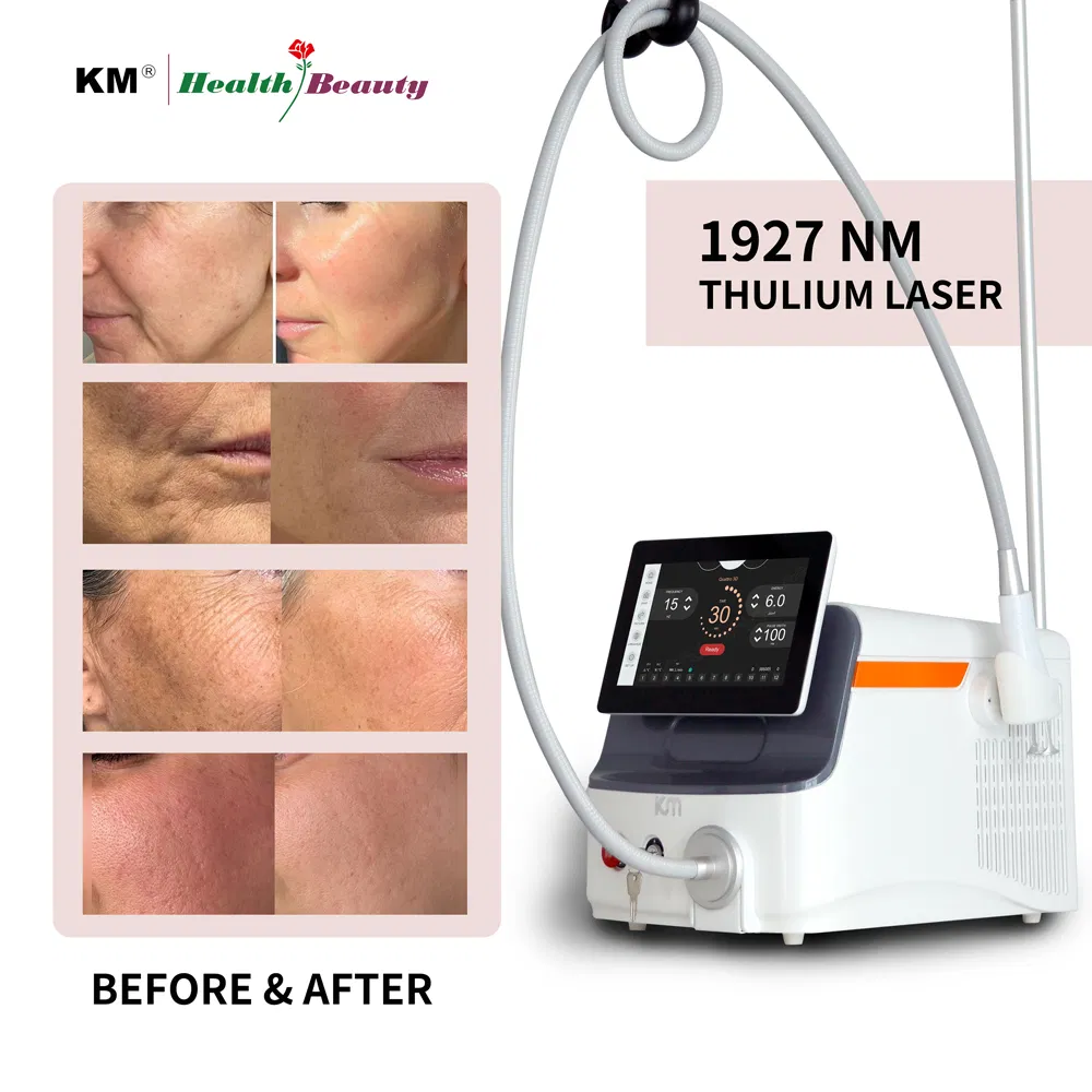 1927nm Thulium Laser System for Pigment Removal &amp; Skin Tightening, Cooling OEM ODM