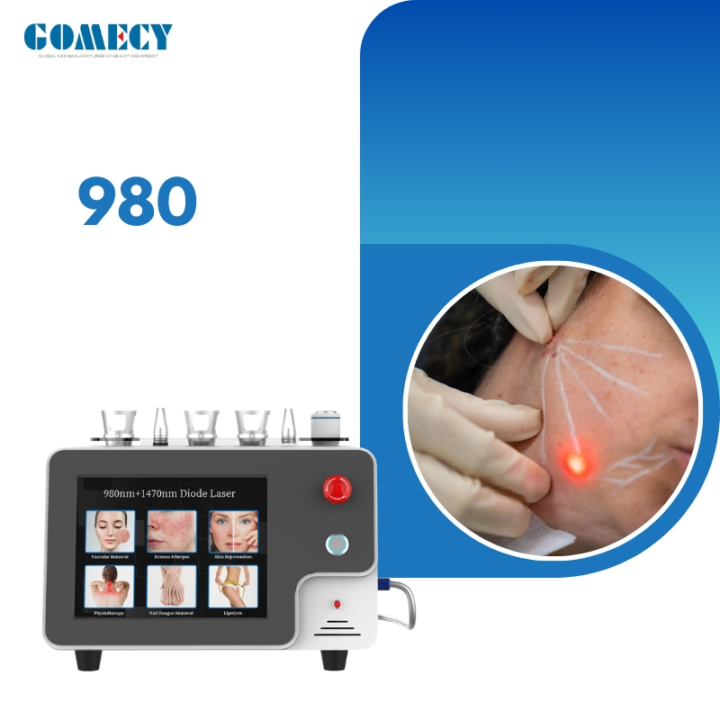 Best 1470nm 980nm Diode Laser for Professional Clinics Endolift and Vascular Therapy