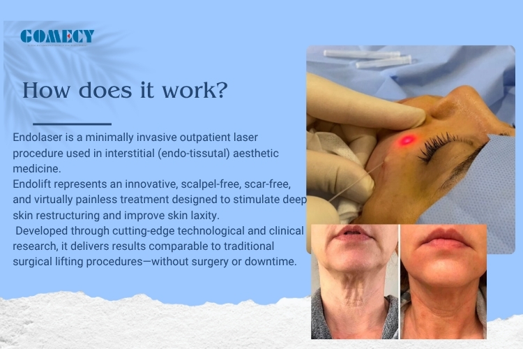 3 in 1 Triple-Wavelength 635/980/1470nm Laser System for Face Lifting Vascular Removal