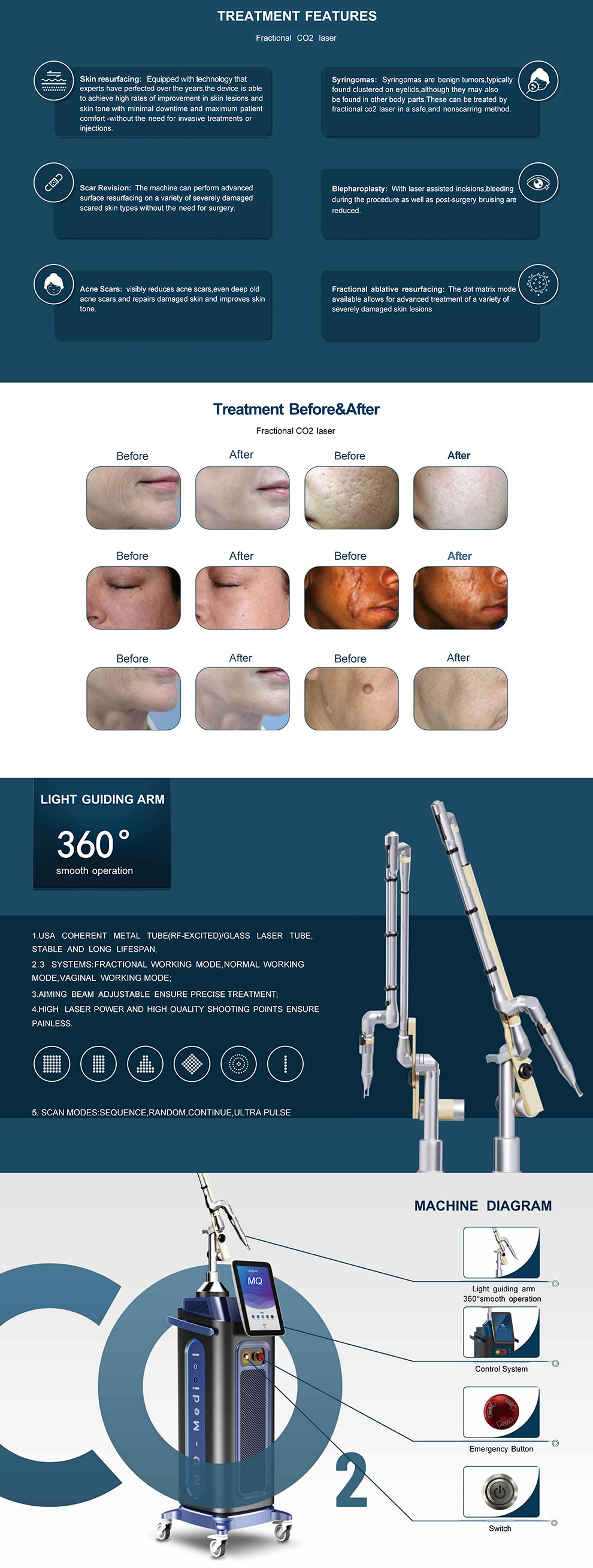Skin Resurfacing