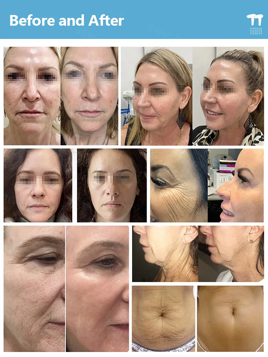 Treatment Result 1