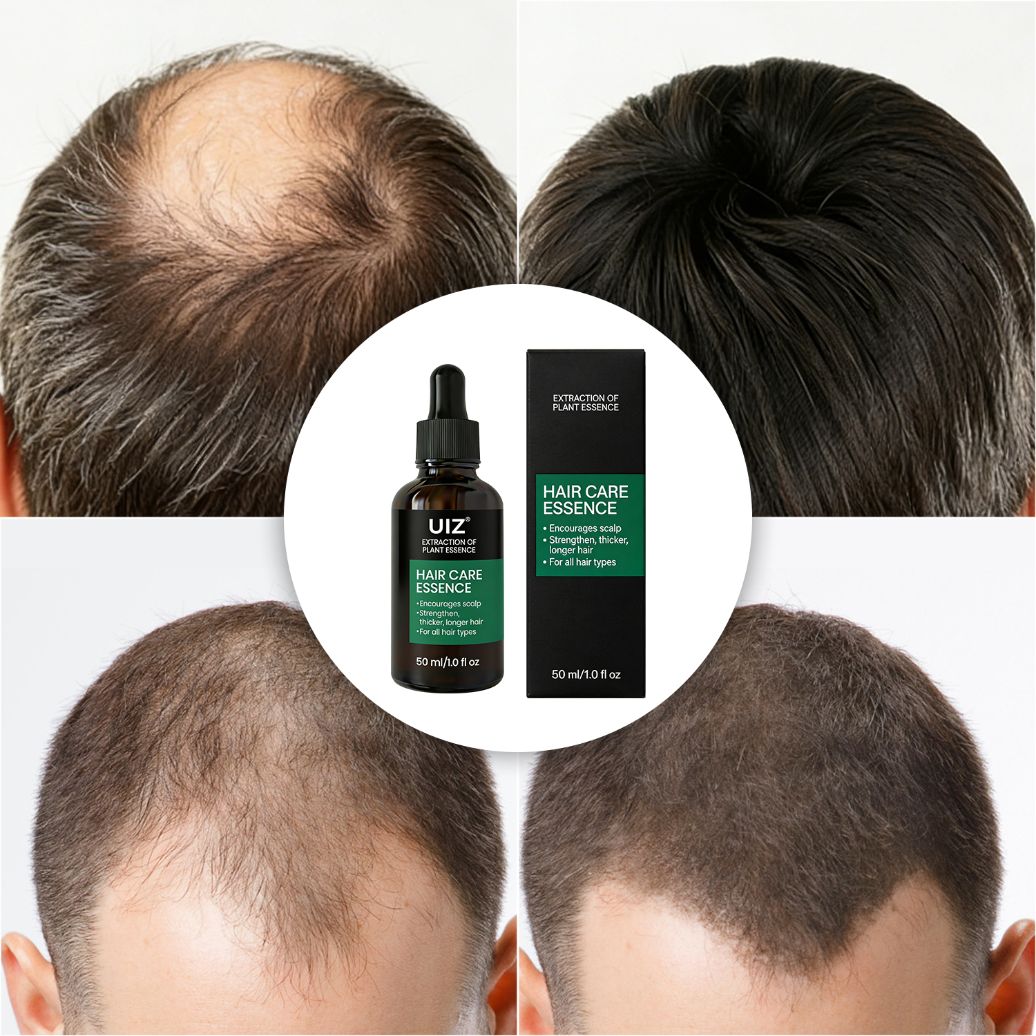 Private Label Hair Growth Oil Organic Baldness Hair Growth Regrowth Serum Oil for Hair Loss Treatment Strengthening Scalp Care