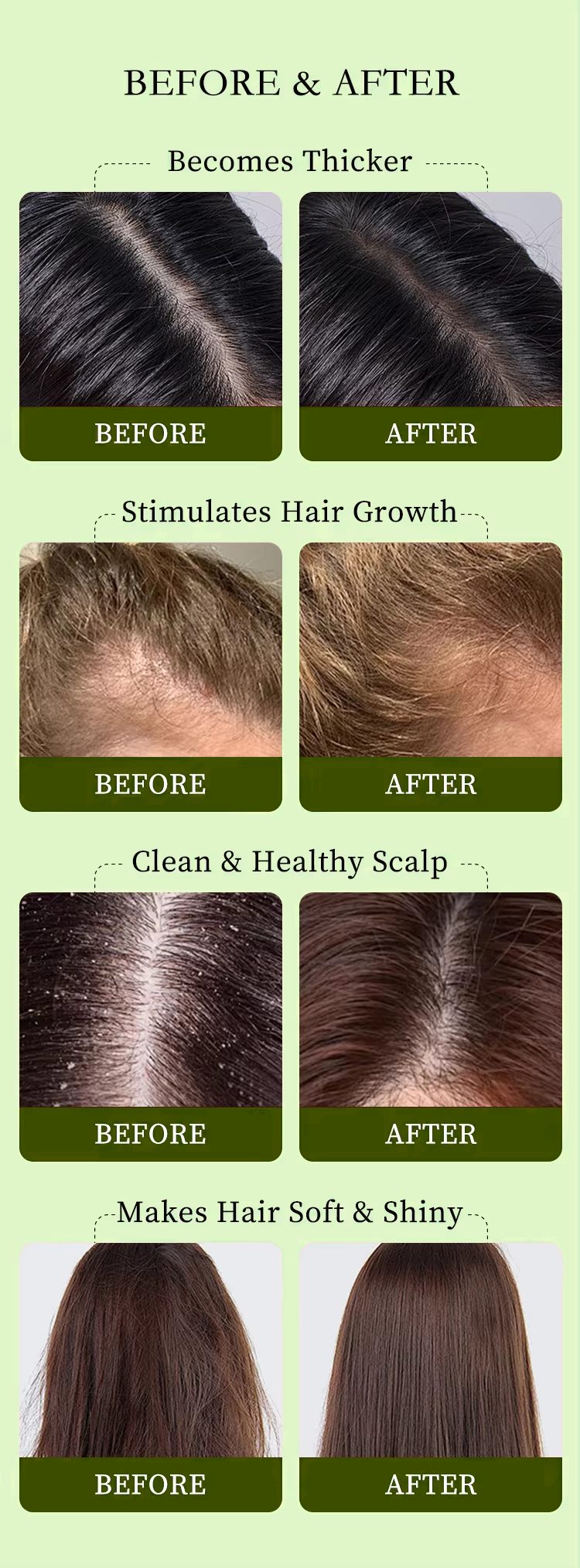 Herbal Hair Serum Oil Regrowth Treatment Vegan Anti Dandruff Nourishing Ginger Hair-loss Prevention Hair Growth Essential Oil