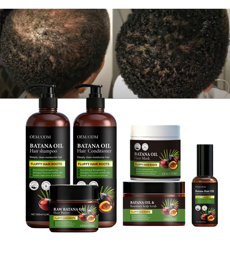 Factory Supply Batana Oil Organic Nourishing Conditioner Kit Regrowth Anti Hair Loss Black Hair Shampoo For Hair Growth