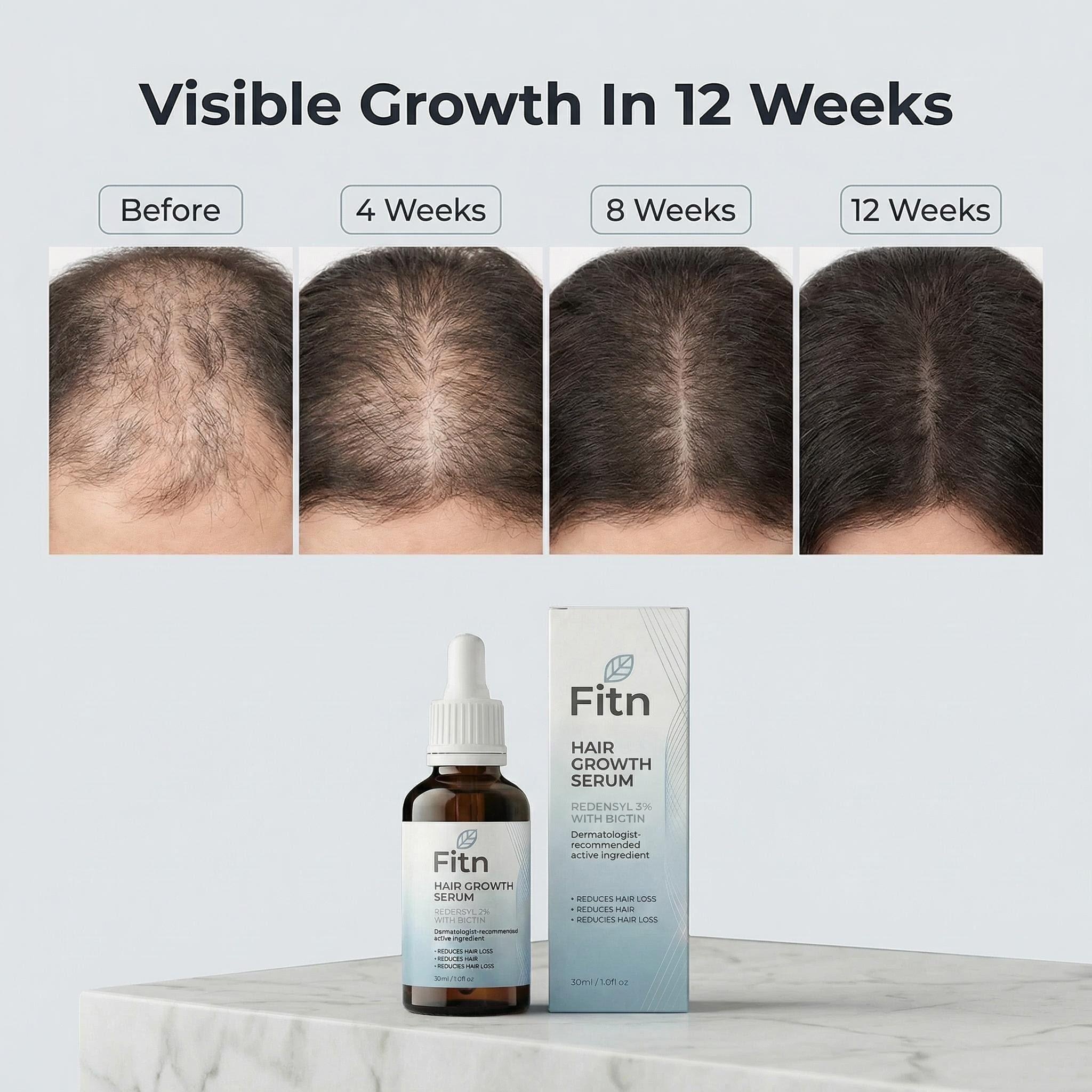 Redensyl 3 Biotin Peptide Hair Growth Serum Reduces Hair Loss Repairs Damage Revitalizes Follicles OEM Private Label Wholesale