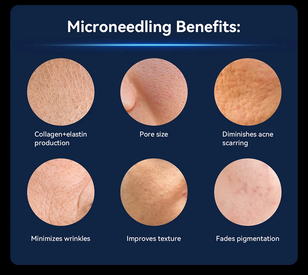 Professional Medical Grade Microneedling Pen Biopen EMS Microneedlng Pen Skincare Device EMS 5 Speeds LED Light Therapy Device for Sales