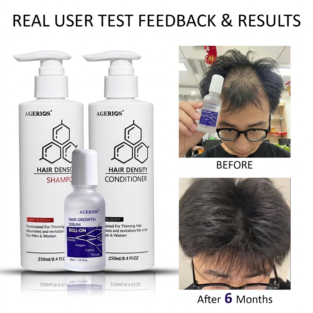 Scalp Delivery Capixyl Hair Growth Serum Multi-Peptide Formula For Hair Density, Thickening &amp; Advanced Regrowth Treatment