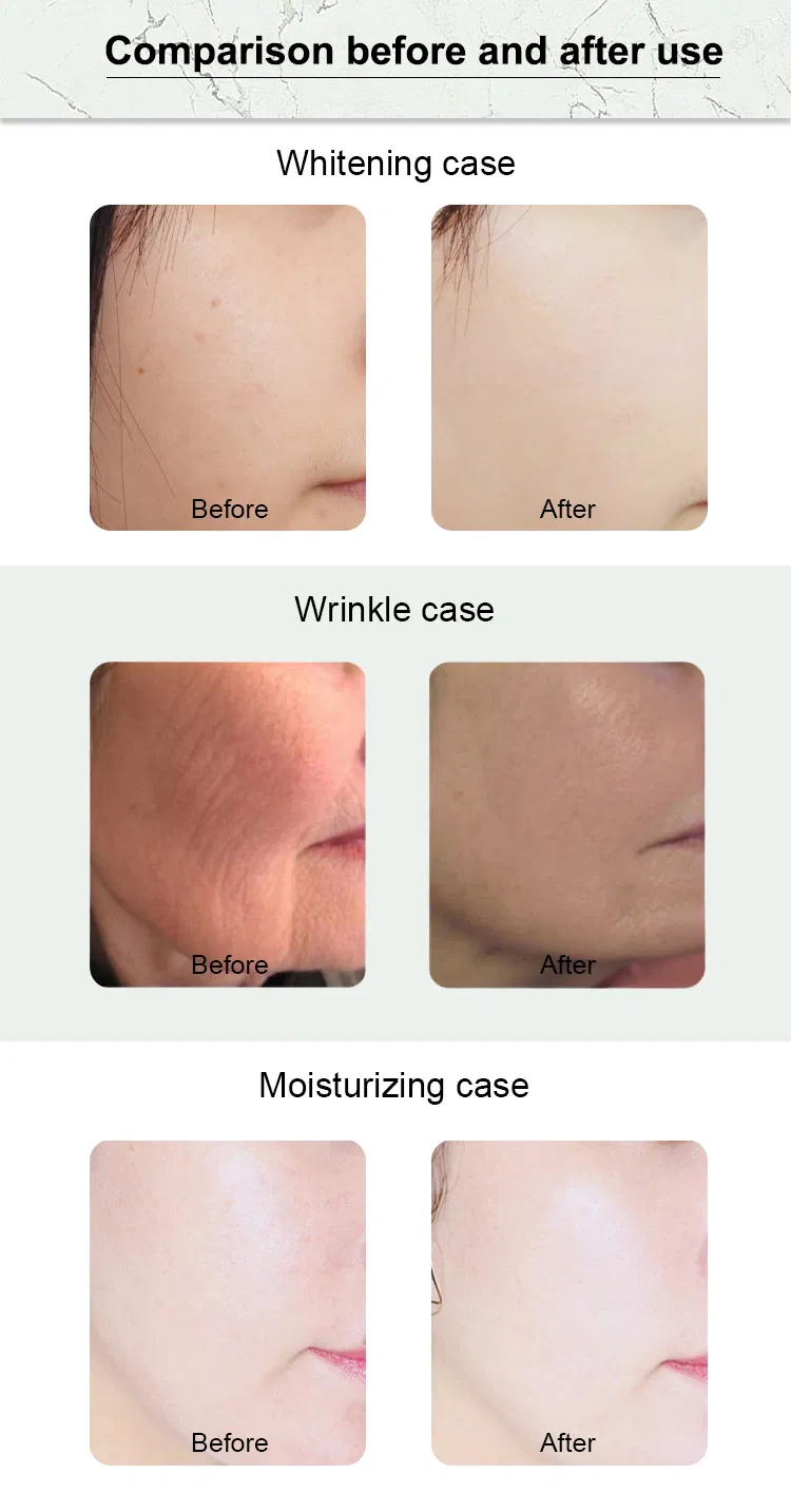 Professional 6 in 1 Blackhead Removal Deep Skin Cleaning Face Lifting Facial Microdermabraion Skincare Facial Machine