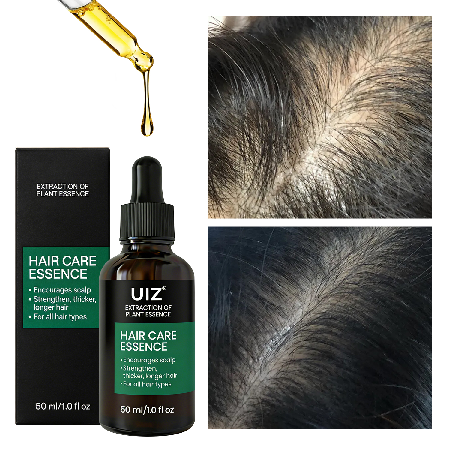 Private Label Hair Growth Oil Organic Baldness Hair Growth Regrowth Serum Oil for Hair Loss Treatment Strengthening Scalp Care