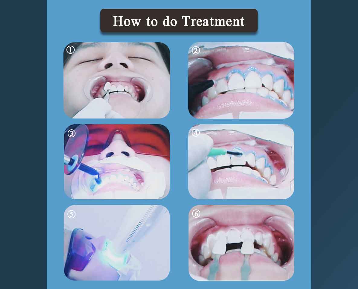 Usage Illustration