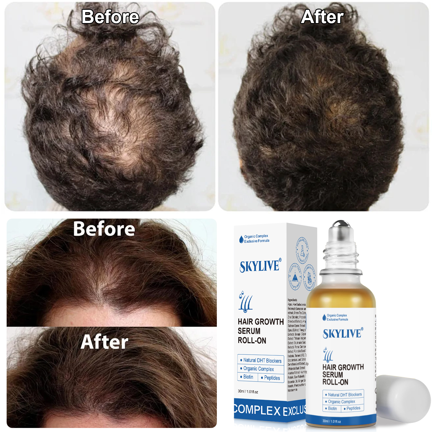 OEM Private Label Hair Nourishing Serum Roll-on for Improving Scalp Nourishing Strengthening Hair Root Hair Care Products