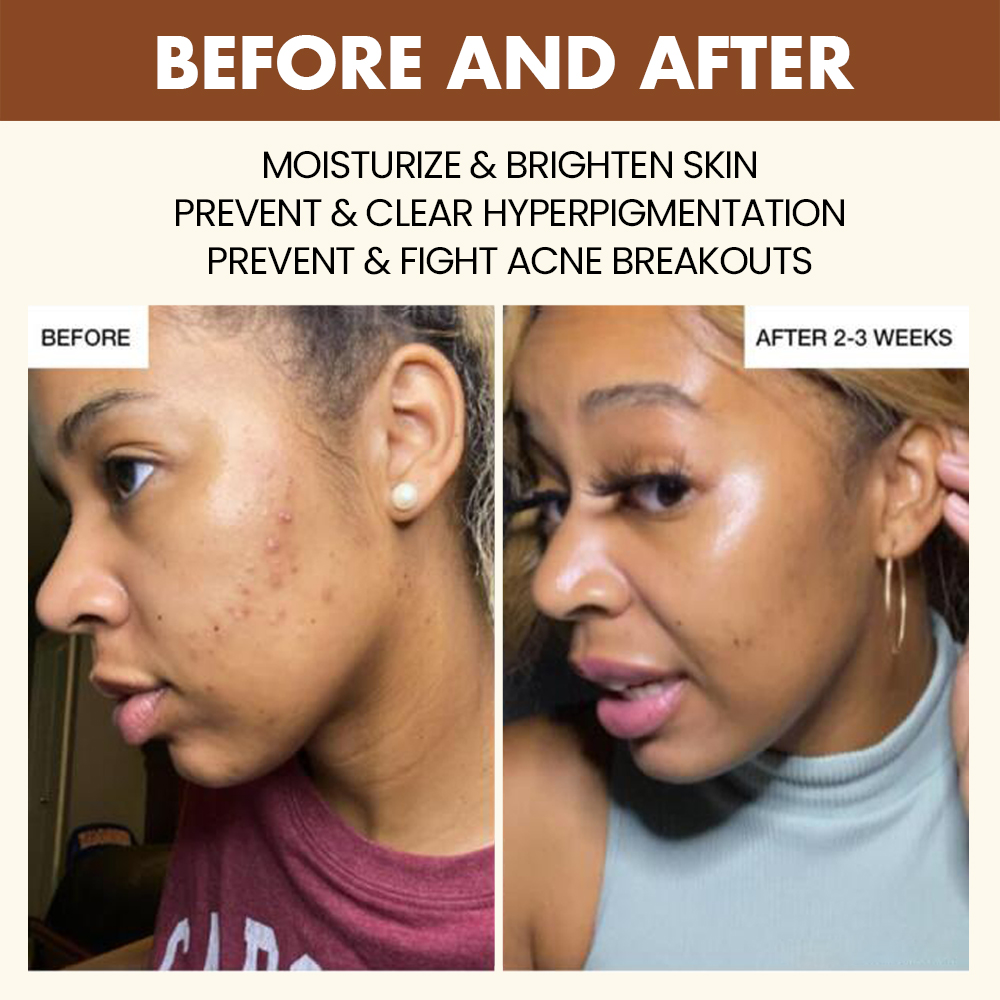 Private Label Caramel Skincare Products Black Skin Brightening Glow Acne Treatment Face Toner Serum Korean Skin Care Set