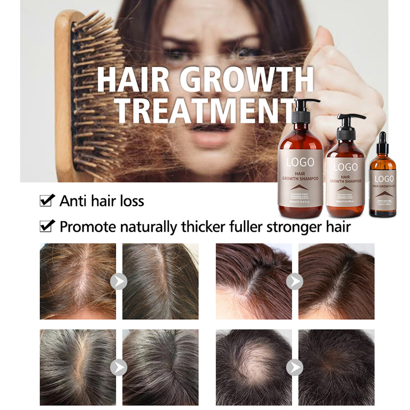 OEM Private Label Organic Strengthening Repair Hair Treatment Extract Hair Growth Oil Keratin Hair Care Shine Serum