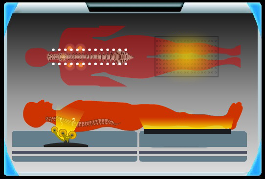 Internal Heat Structure