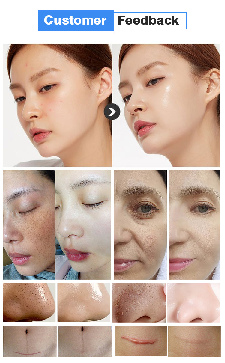 Treatment Result 1