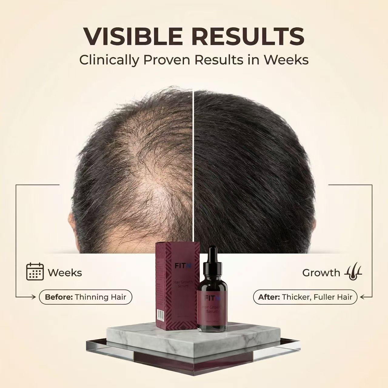 Hair Growth Serum OEM Private Label Custom Logo Scalp Treatment Anti Hair Loss Regrowth Bulk Wholesale Factory Price Pure Supply
