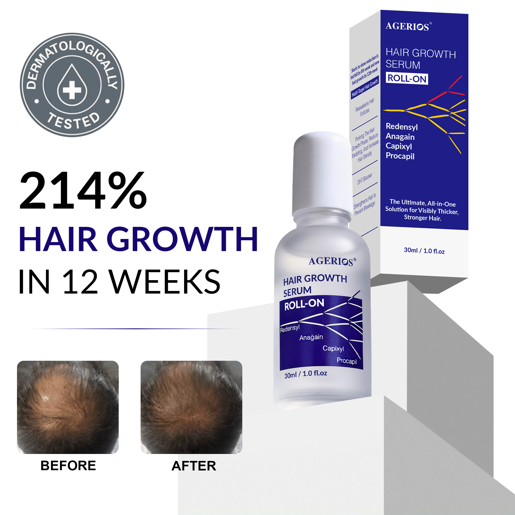 Scalp Delivery Capixyl Hair Growth Serum Multi-Peptide Formula For Hair Density, Thickening &amp; Advanced Regrowth Treatment
