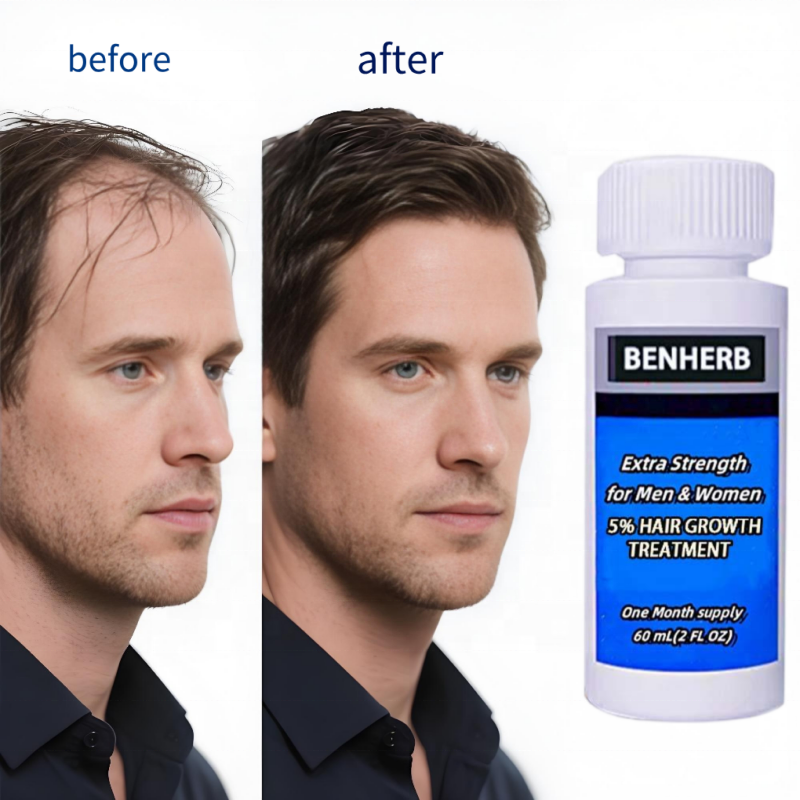 2025 Stock 6-in-1 Professional Herbal Nourishing Hair-Repairing Hair Care Kit Hair Growth Regrowth 5% Liquid Solution 60ml