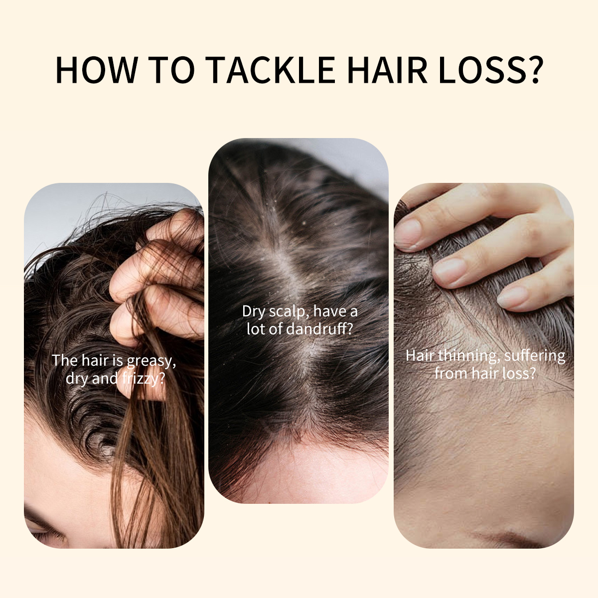 Custom Logo Paraben Free Sulphate Free Salon Herbal Rosemary Biotin Frizzy Hair Growth Red Onion Shampoo Conditioner