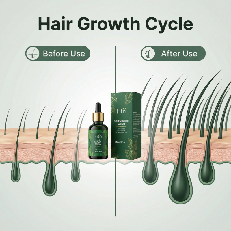 Private Label Hair Growth Oil Natural Organic Scalp Nourishing Fast Hair Regrowth Treatment Root Lifting 2-IN-1 Squalane Unisex