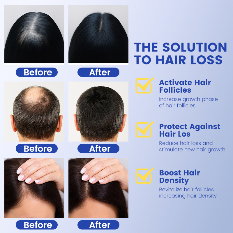 Cruelty Free 1%GHK-Cu Copper Peptide Hair Growth Serum DHT Blocker Thinning Hair Nourishes Scalp &amp; Promotes Peptide Hair Serum