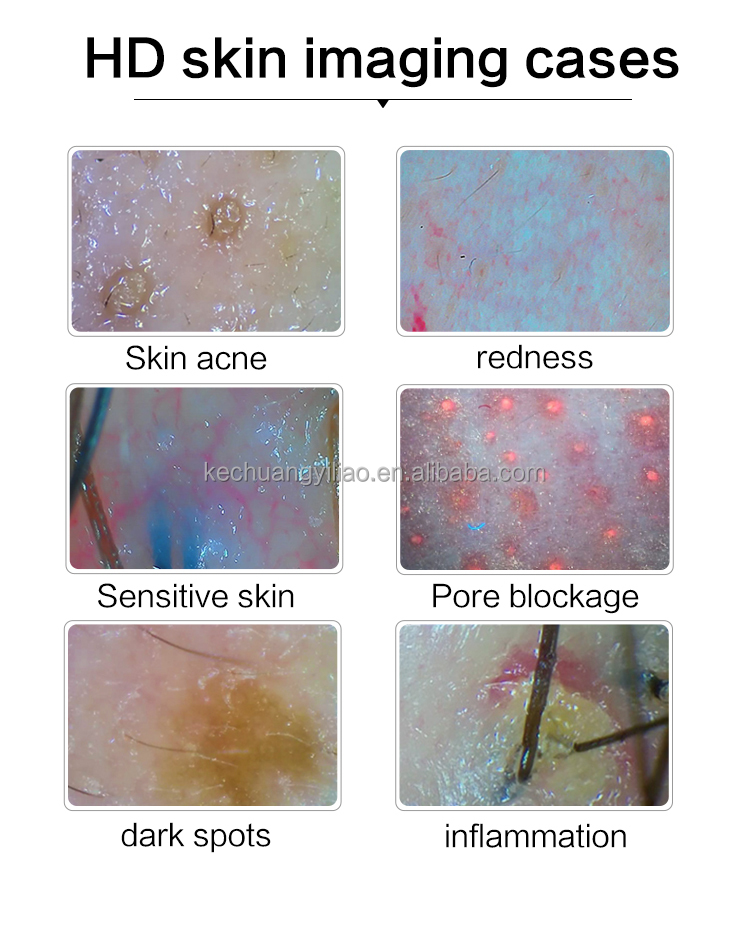 2024 Multi-function Skin Analyzer Hair Detector Beauty Salon Dedicated Hair Regeneration Treatment Scalp Analyzer