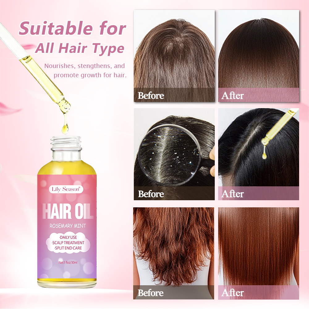Hair Care Scalp &amp; Root Repair Split Ends Reduce Frizz Nourishing Rejuvenating 30ml Dropper Natural Herbal Rosemary Essential Oil