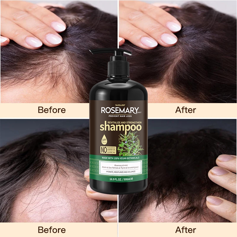 OCCA Factory Oem Natural Organic Custom Vegan Hair Loss Rosemary Mint Tea Tree Oil Hair Growth Shampoo And Conditioner Set