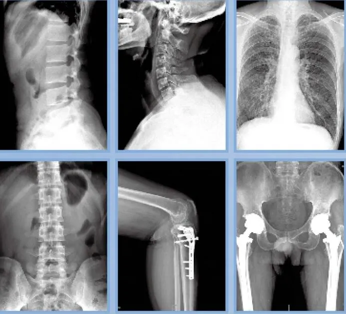 X-ray Machine View 7