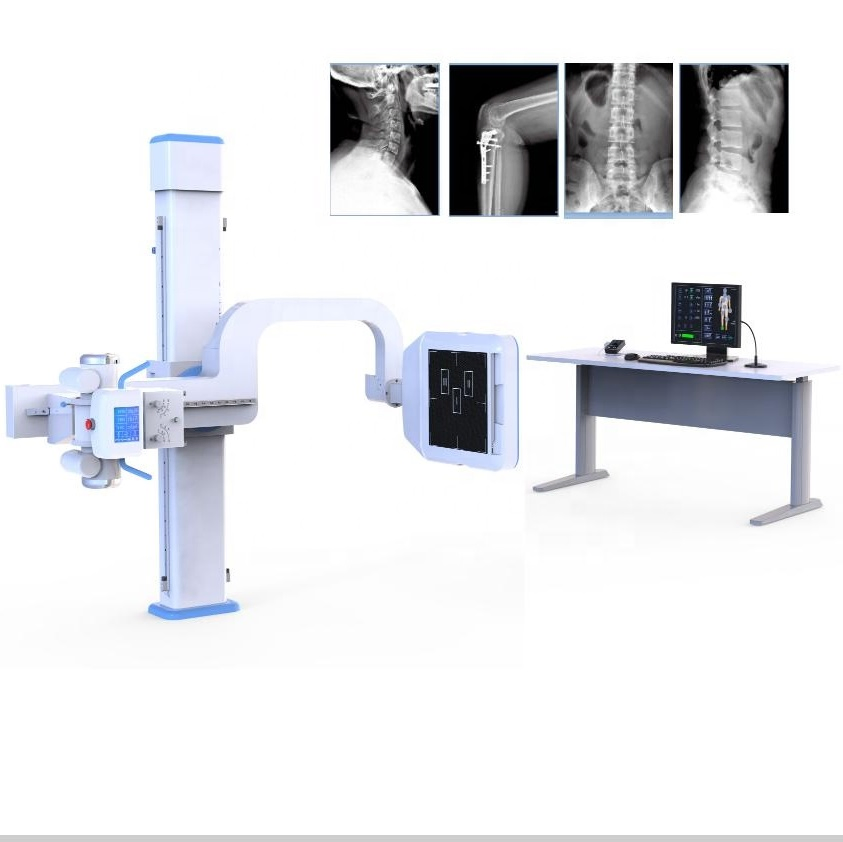 Digital Radiography X-ray Machine with High Frequency Generator X Ray Diagnostic System Radiography Equipment