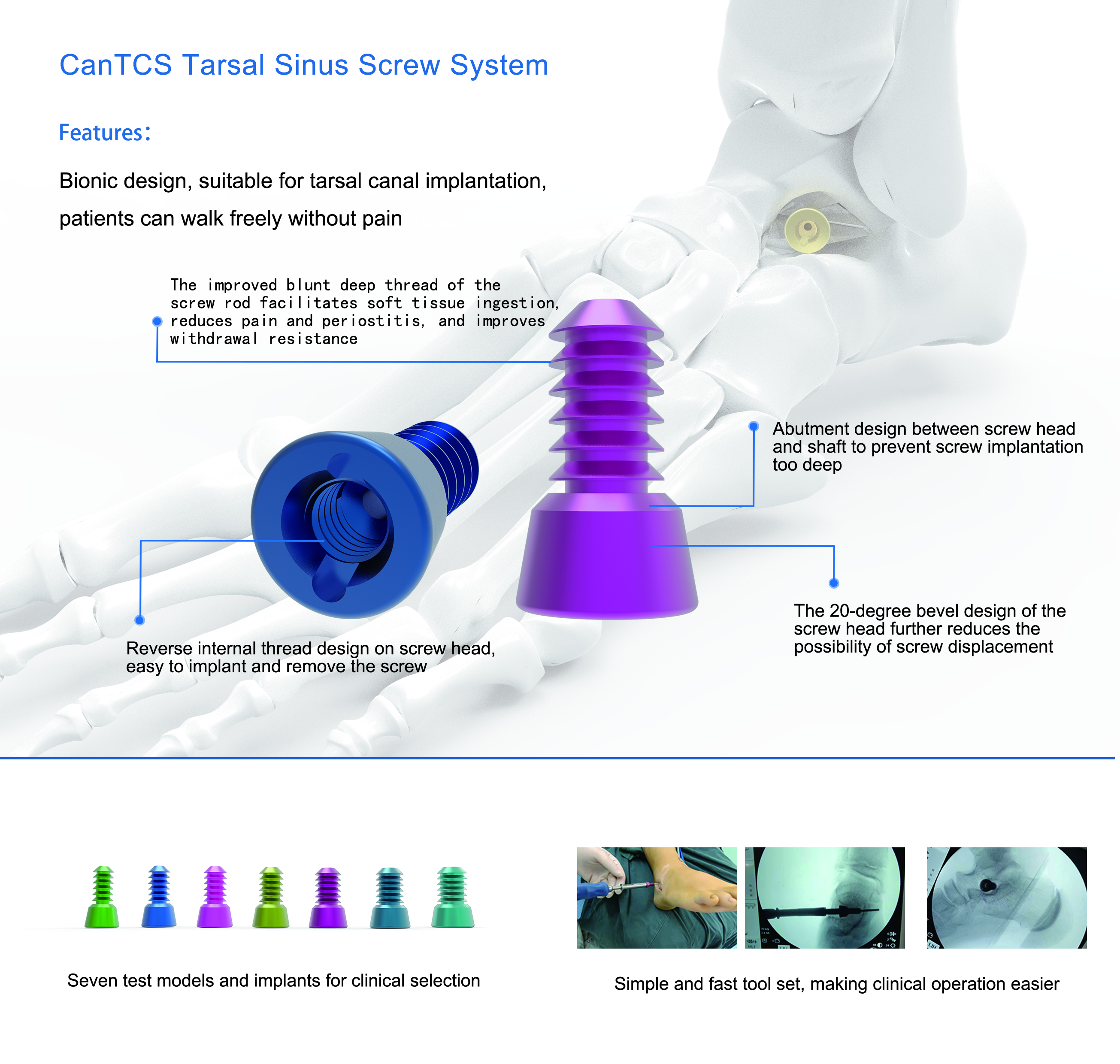 CANWELL Sinus Tarsal Locking Screw Titanium Orthopedic Implant and Instrument Foot Ankle CE ISO Manufacturer 2.4/2.7mm Class II