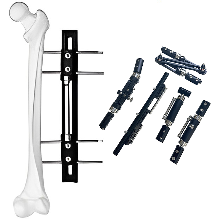High Quality Orthopedic External Fixation Femur and Tibial External Fixator