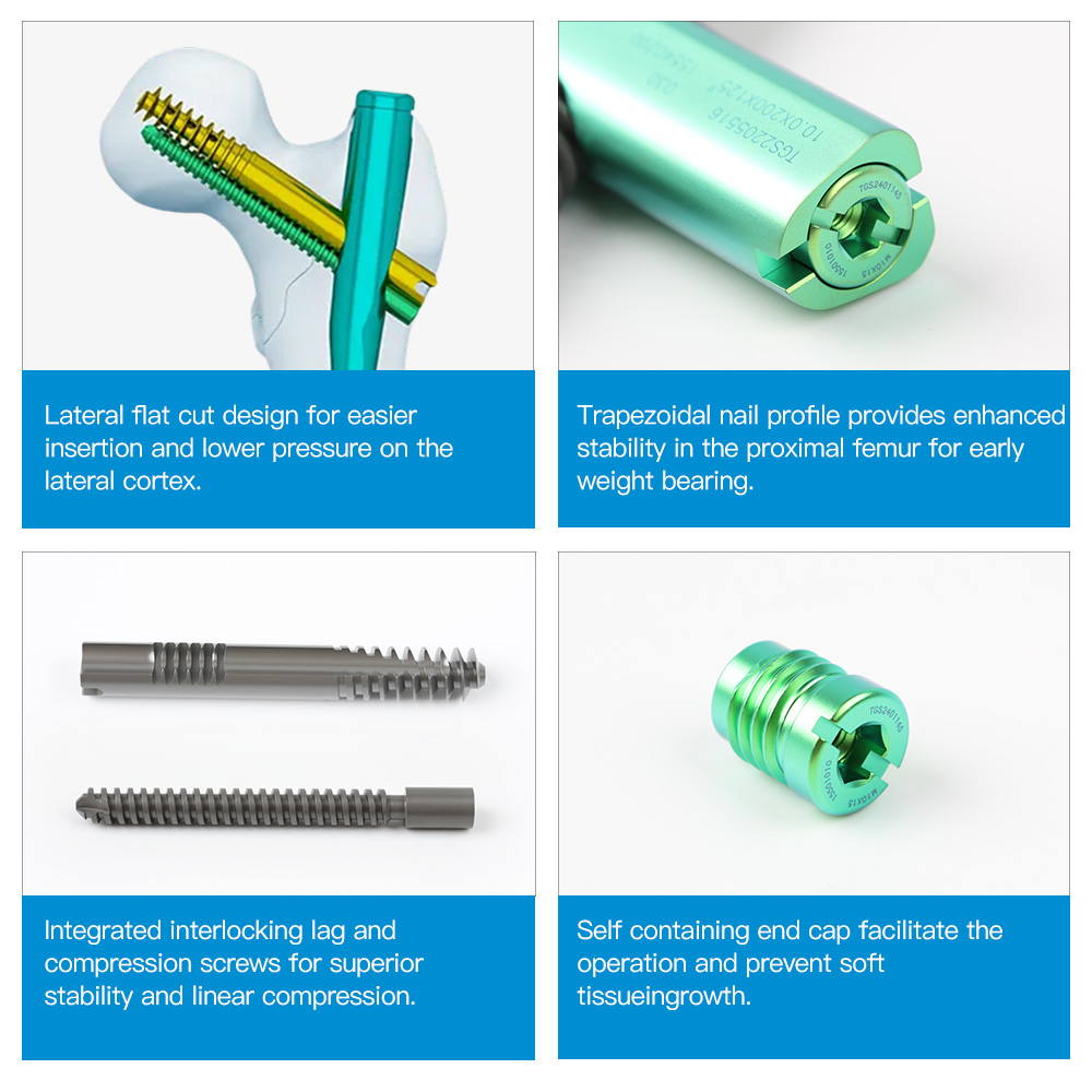 Geasure Titanium Intramedially Nail (PFNA/INTERTAN) Double Blade Femoral Interlocking Nail Implants Interventional Materials