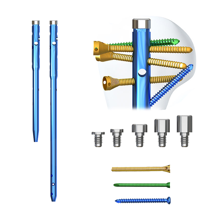 Geasure Trauma Orthopedic Implants Interlocking Titanium Alloy Multi-Lock Humeral Intramedullary Nail CE ISO Certified Class III